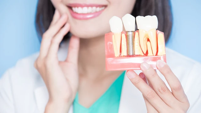 bai-viet/trong-rang-implant-la-gi-cau-tao-cua-rang-implant.html