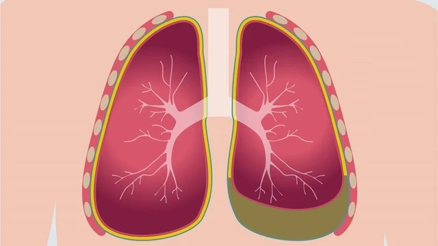 bai-viet/truong-hop-dich-mang-phoi-mau-do-la-gi.html