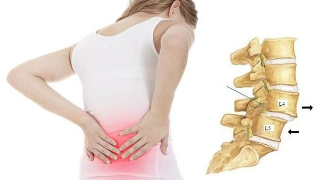 bai-viet/truot-dot-song-ra-truoc-l4-l5-va-nhung-dieu-can-biet.html