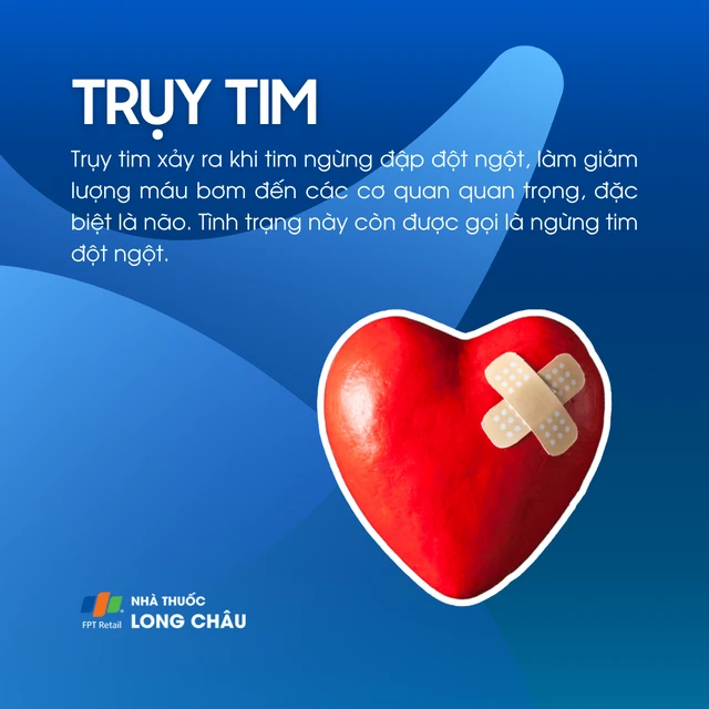 Trụy tim là gì? Nguyên nhân, triệu chứng và cách điều trị