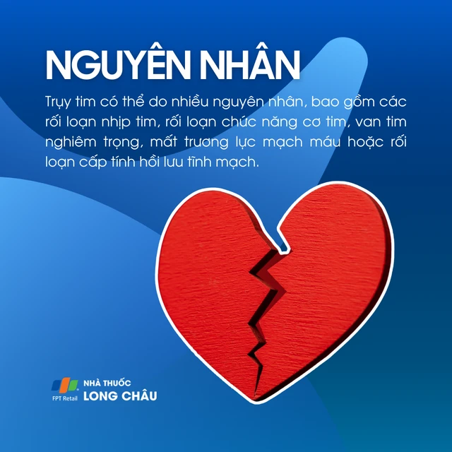 Trụy tim là gì? Nguyên nhân, triệu chứng và cách điều trị