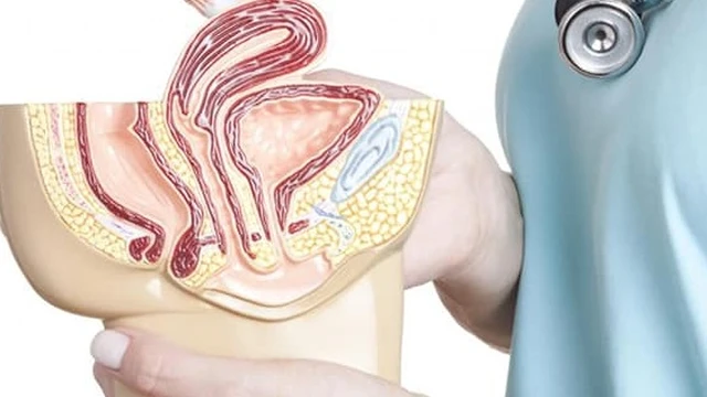 bai-viet/tu-cung-nga-sau-anh-huong-nhu-the-nao-den-viec-mang-thai-53877.html