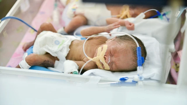 bai-viet/tu-vong-chu-sinh-la-gi-nguyen-nhan-va-cac-yeu-to-nguy-co-gay-tu-vong-chu-sinh.html