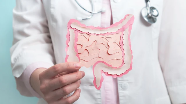 Túi thừa Meckel: Nguyên nhân, triệu chứng và cách điều trị hiệu quả