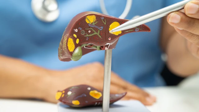 bai-viet/u-gan-lanh-tinh-nen-uong-thuoc-gi-de-kiem-soat-kich-thuoc-khoi-u.html