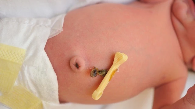 bai-viet/u-hat-ron-o-tre-so-sinh-va-nhung-dieu-can-biet-68557.html