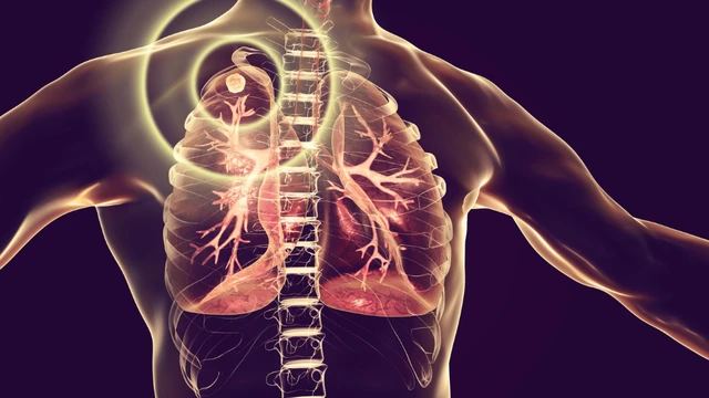 bai-viet/u-lao-la-gi-phan-biet-u-lao-va-ap-xe-lao.html