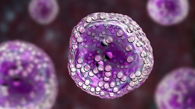 bai-viet/u-lympho-co-nguy-hiem-khong-phuong-phap-phong-benh-u-lympho.html