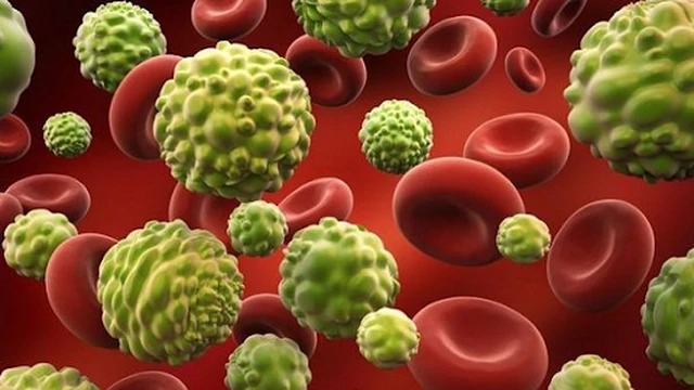 bai-viet/u-nguyen-bao-than-kinh-tre-em-nhung-yeu-to-nguy-co-57037.html