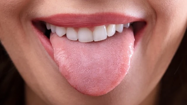 bai-viet/u-nhu-tien-dinh-o-mieng-luoi-cach-dieu-tri-va-phong-tranh.html