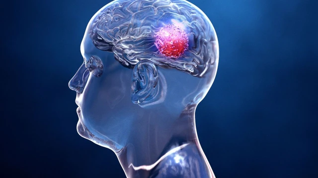 bai-viet/u-so-hau-nguyen-nhan-trieu-chung-va-phuong-phap-dieu-tri.html