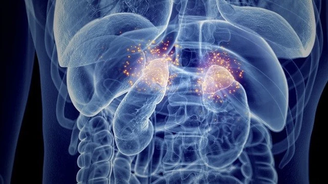 bai-viet/u-tuyen-thuong-than-trai-la-gi-phuong-phap-chan-doan-va-dieu-tri.html