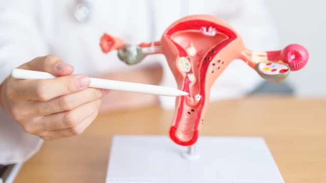 bai-viet/ung-thu-co-tu-cung-co-chua-duoc-khong-ty-le-song-la-bao-nhieu.html