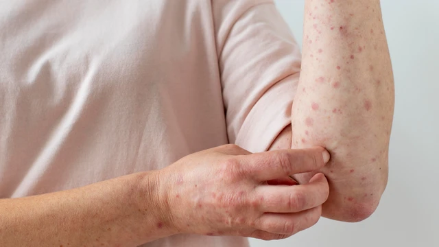 bai-viet/ung-thu-da-co-di-truyen-khong.html