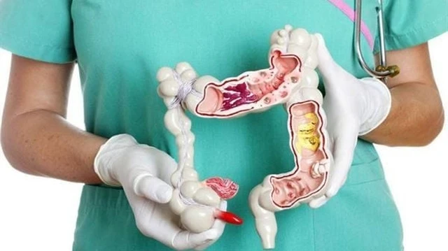 bai-viet/ung-thu-dai-truc-trang-di-can-la-gi-chan-doan-ung-thu-dai-truc-trang-di-can-nhu-the-nao.html