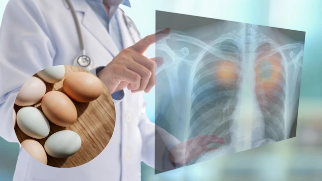 bai-viet/ung-thu-phoi-co-an-trung-ga-duoc-khong-huong-dan-an-dung-cach.html