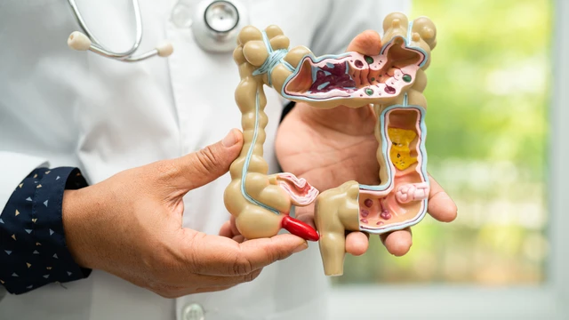 benh/ung-thu-ruot-gia-430.html