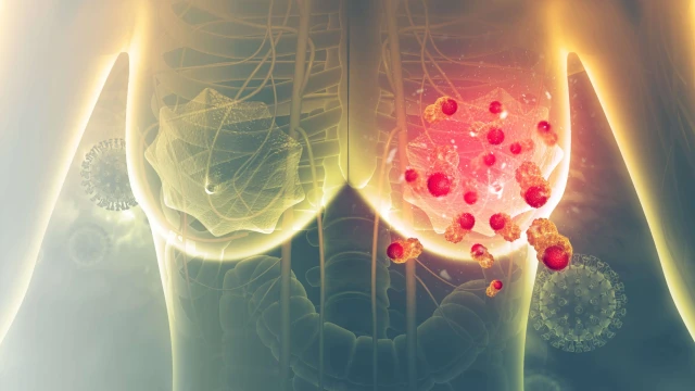 bai-viet/ung-thu-vu-di-can-gan-la-gi-55948.html