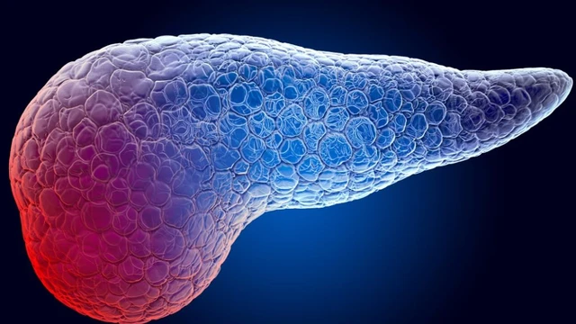 bai-viet/uong-gi-de-phuc-hoi-tuyen-tuy-bi-viem-thuc-pham-benh-nhan-viem-tuy-nen-tranh.html