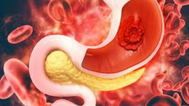 bai-viet/uong-nghe-mat-ong-tri-hp-da-day-lieu-co-thuc-su-hieu-qua-khong.html