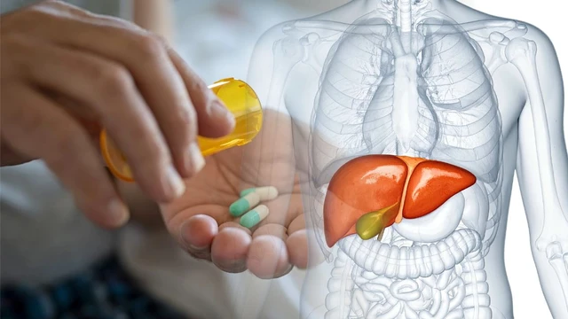 Uống thuốc dị ứng có hại gan không? Cách sử dụng để hạn chế ảnh hưởng
