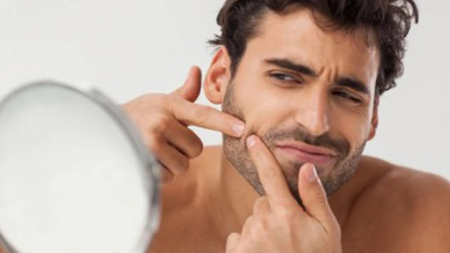 bai-viet/uong-whey-co-noi-mun-khong-56680.html