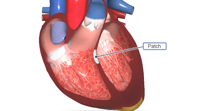 bai-viet/va-thong-lien-that-duoc-thuc-hien-nhu-the-nao.html