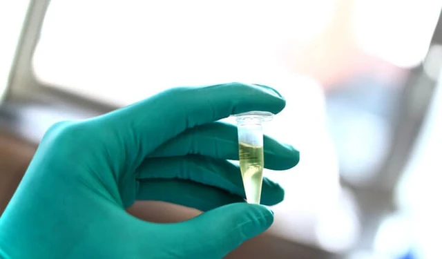 bai-viet/vai-tro-cua-dich-nao-tuy-la-gi-muc-dich-xet-nghiem-dich-nao-tuy.html