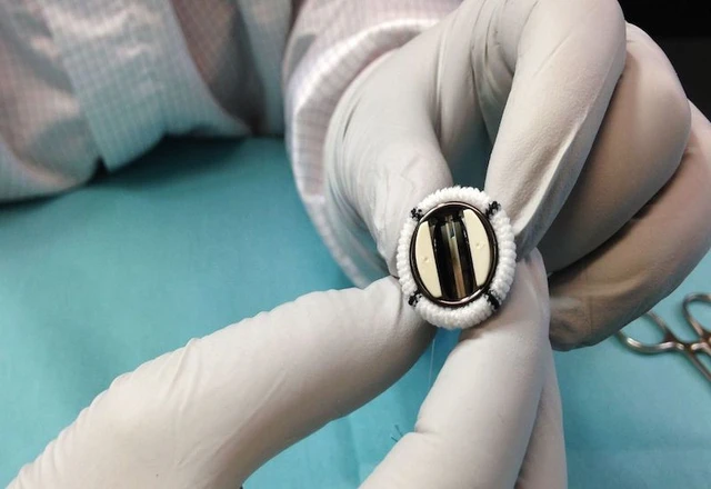 bai-viet/van-tim-nhan-tao-la-gi-cach-chon-van-tim-nhan-tao-phu-hop-nhat.html