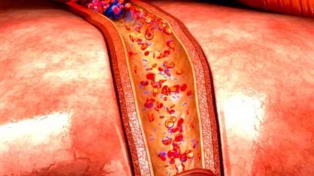 bai-viet/van-toc-mau-cao-nhat-o-dau-tim-hieu-ve-van-toc-mau-bat-thuong-va-cac-benh-lien-quan.html