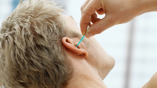 bai-viet/vanh-tai-bi-ngua-chay-nuoc-vang-la-do-dau-va-khac-phuc-nhu-the-nao-55727.html