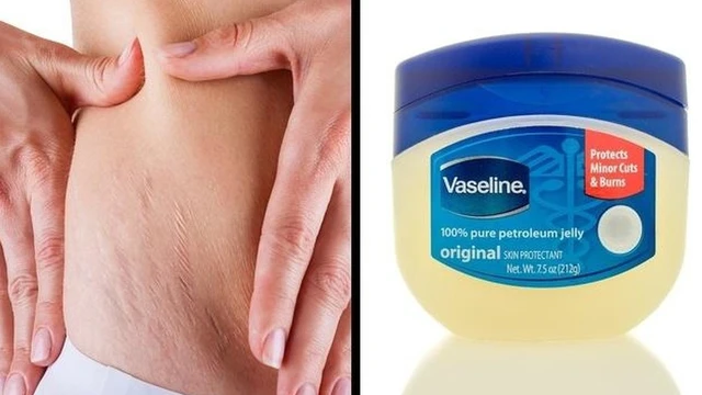 bai-viet/vaseline-co-tri-ran-da-khong.html