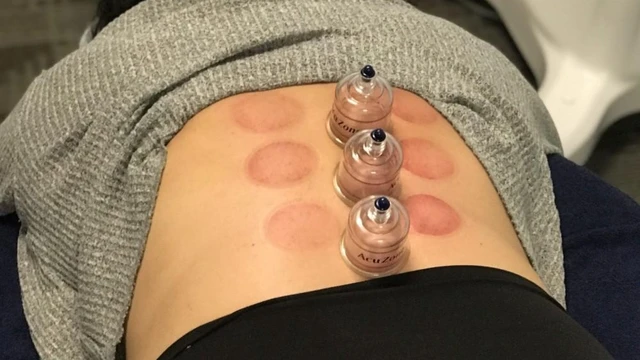 bai-viet/vi-sao-co-vet-bam-tim-khi-giac-hoi-co-anh-huong-den-suc-khoe-khong.html