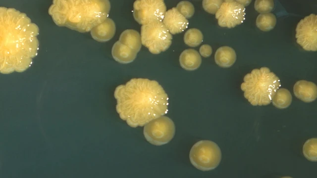 bai-viet/vi-khuan-cronobacter-sakazakii-moi-nguy-dac-biet-voi-tre-so-sinh.html