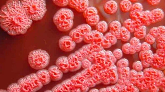 bai-viet/vi-khuan-gay-benh-whitmore-la-gi-con-duong-lay-nhiem-cua-benh.html