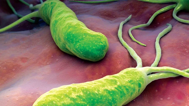 bai-viet/vi-khuan-hp-lay-qua-duong-nao-cac-bien-phap-phong-tranh-vi-khuan-hp-1.html