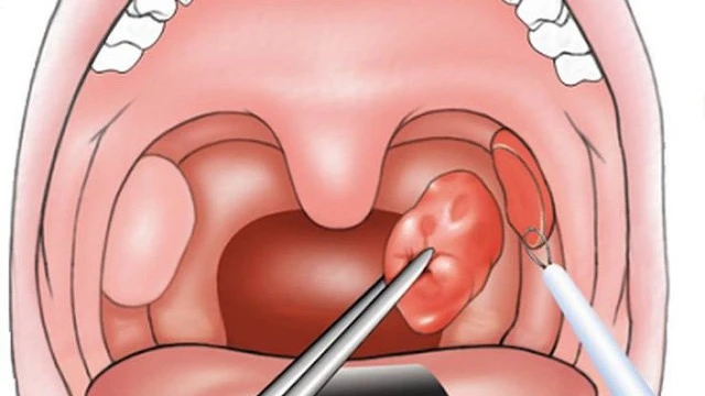 bai-viet/vi-sao-be-nao-va-xong-van-bi-so-mui-co-nguy-hiem-khong-56034.html