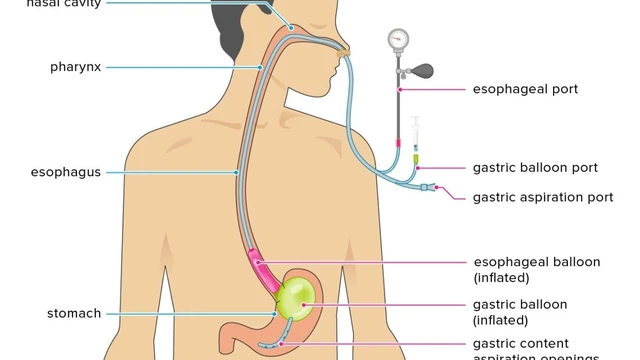 bai-viet/vi-sao-can-dat-ong-thong-da-day-cho-tre-so-sinh-cach-cham-soc-tre-khi-dat-ong.html