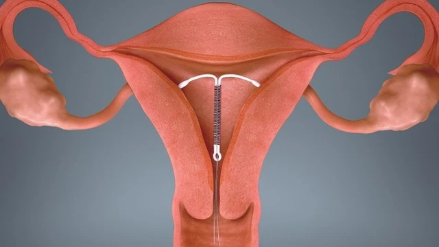 bai-viet/vi-sao-dat-vong-tranh-thai-van-co-thai-mang-thai-khi-dat-vong-tranh-thai-co-sao-khong.html