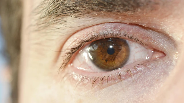 benh/viem-than-kinh-thi-giac-558.html