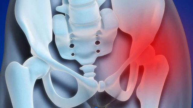 bai-viet/viem-khop-hang-tran-dich-nguyen-nhan-trieu-chung-cach-dieu-tri-52155.html