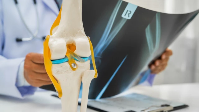 Viêm khớp không đặc hiệu