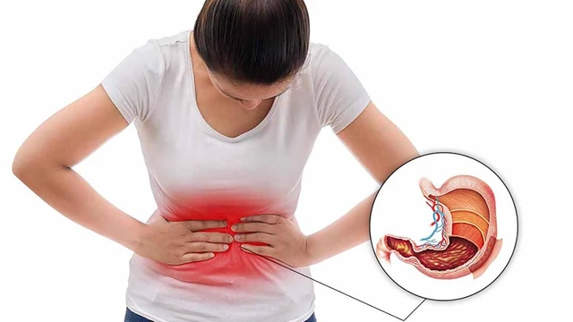 bai-viet/viem-loet-da-day-co-nguy-hiem-khong-phuong-phap-dieu-tri-va-phong-ngua-72934.html