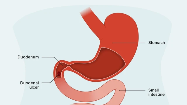 bai-viet/viem-loet-hanh-ta-trang-nguyen-nhan-trieu-chung-va-chua-tri.html