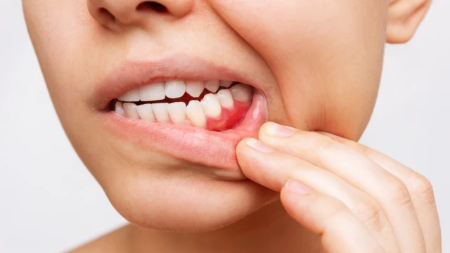 bai-viet/viem-nha-chu-bao-lau-thi-khoi-cach-chua-viem-nha-chu-nhanh-khoi.html