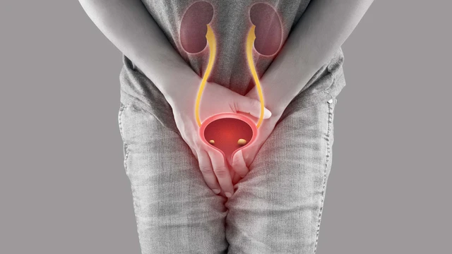 bai-viet/viem-nieu-dao-nu-co-tu-khoi-khong-dieu-tri-nhu-the-nao.html