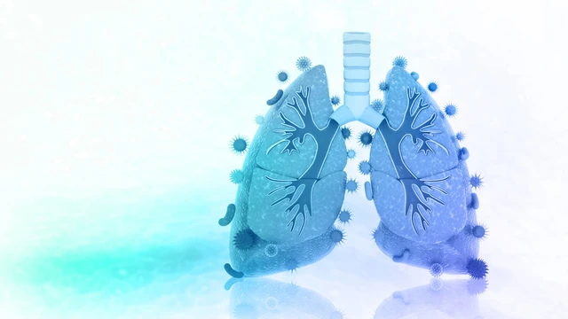 Viêm phổi cộng đồng