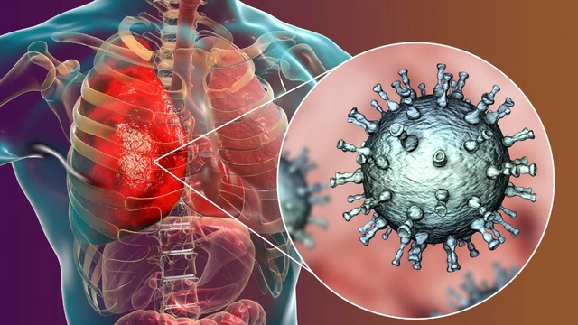 bai-viet/viem-phoi-do-cum-a-nguyen-nhan-trieu-chung-cach-dieu-tri.html