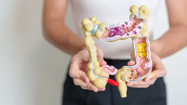 benh/viem-ta-trang-407.html