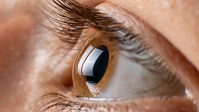benh/viem-thi-than-kinh.html